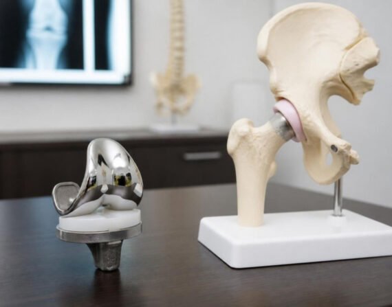 Joint Replacement in Vanasthalipuram