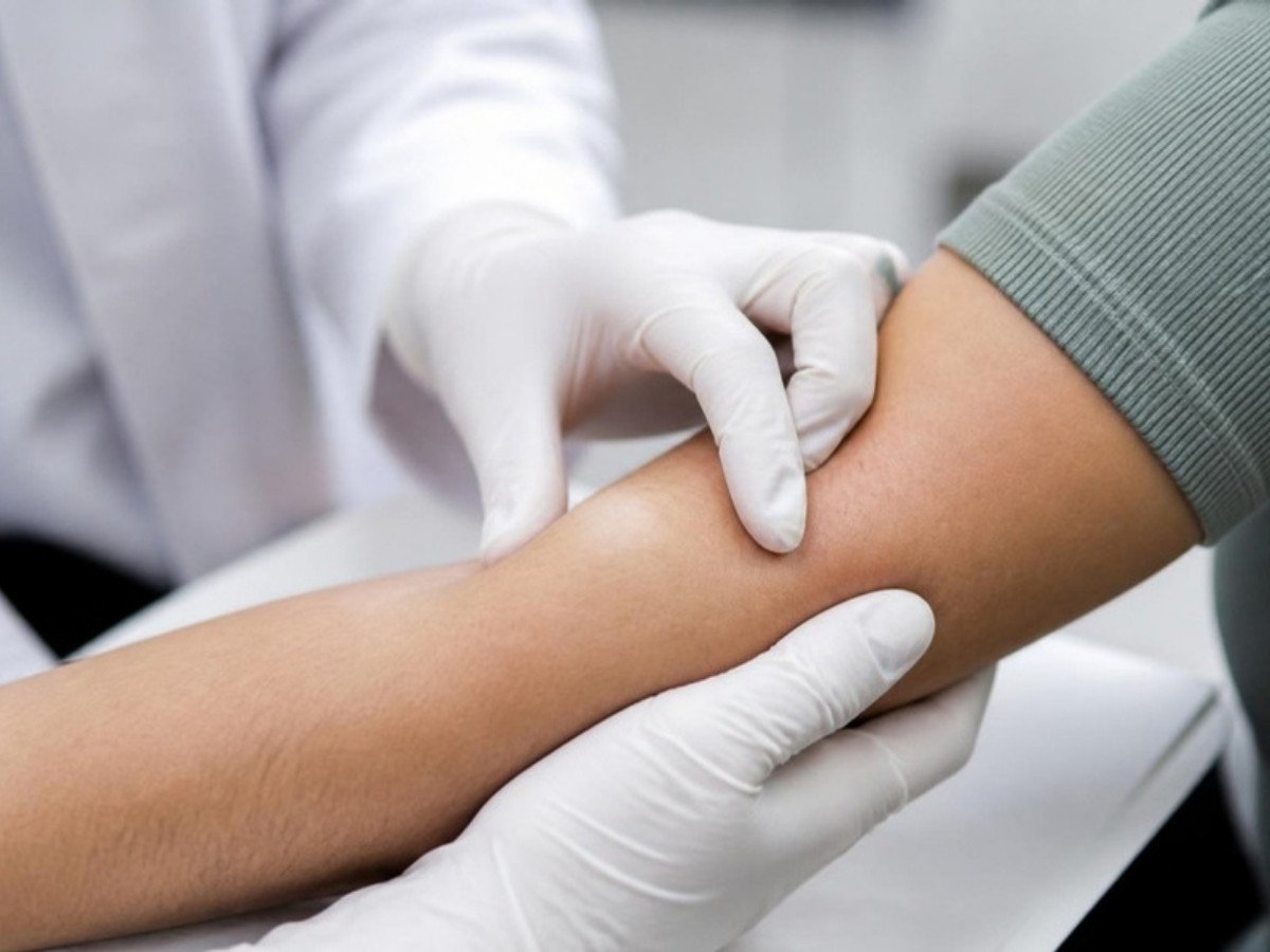 Doctor examining a lump on the forearm, lumps and cysts treatment
